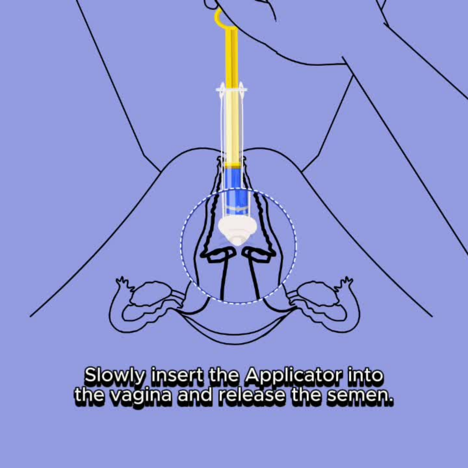 Applicator Extra